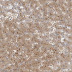 Immunohistochemical staining of human liver shows moderate positivity in bile canaliculi in hepatocytes.
