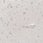Immunohistochemical staining of human cerebral cortex shows moderate positivity in neuronal processes in astrocytes.