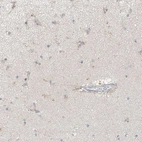 Immunohistochemical staining of human cerebral cortex shows moderate positivity in neuronal processes in astrocytes.