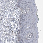 Immunohistochemical staining of human skin shows no positivity in keratinocytes as expected.