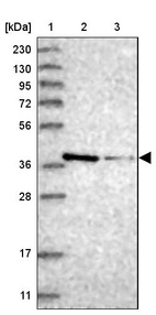 Lane 1: Marker [kDa] 230, 130, 95, 72, 56, 36, 28, 17, 11_br/_Lane 2: Human cell line RT-4_br/_Lane 3: Human cell line U-251MG sp