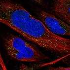 Immunofluorescent staining of human cell line U-2 OS shows localization to vesicles.