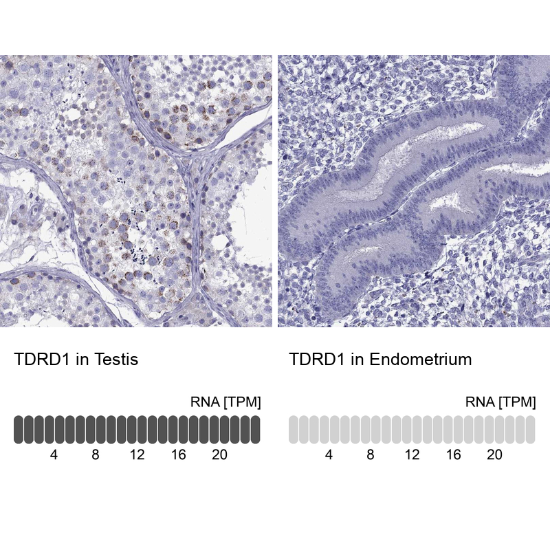 Anti-TDRD1 Antibody