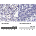 Anti-TDRD1 Antibody