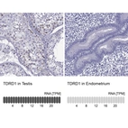 Anti-TDRD1 Antibody