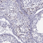 Immunohistochemical staining of human testis shows high expression.