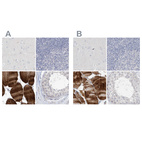 Immunohistochemical staining of human cerebral cortex, lymph node, skeletal muscle and testis using Anti-MYOT antibody HPA037733 (A) shows similar protein distribution across tissues to independent antibody HPA037734 (B).