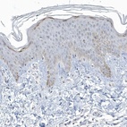 Immunohistochemical staining of human skin shows low expression as expected.