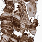 Immunohistochemical staining of human skeletal muscle shows high expression.