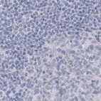 Immunohistochemical staining of human lymph node using Anti-MYOT antibody HPA037733.