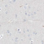 Immunohistochemical staining of human cerebral cortex using Anti-MYOT antibody HPA037733.