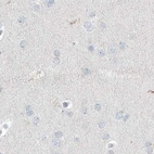 Immunohistochemical staining of human cerebral cortex using Anti-MYOT antibody HPA037733.