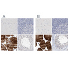 Immunohistochemical staining of human cerebral cortex, lymph node, skeletal muscle and testis using Anti-MYOT antibody HPA037734 (A) shows similar protein distribution across tissues to independent antibody HPA037733 (B).