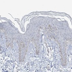 Immunohistochemical staining of human skin shows low expression as expected.