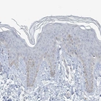 Immunohistochemical staining of human skin shows low expression as expected.