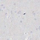 Immunohistochemical staining of human cerebral cortex using Anti-MYOT antibody HPA037734.