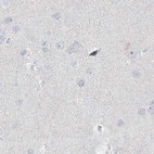 Immunohistochemical staining of human cerebral cortex using Anti-MYOT antibody HPA037734.