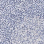 Immunohistochemical staining of human lymph node using Anti-MYOT antibody HPA037734.