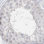 Immunohistochemical staining of human testis using Anti-MYOT antibody HPA037734.