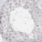 Immunohistochemical staining of human testis using Anti-MYOT antibody HPA037734.