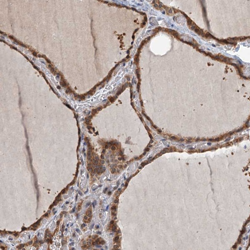 Anti-ZNF527 Antibody