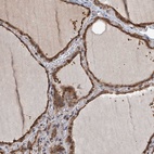 Anti-ZNF527 Antibody