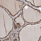 Anti-ZNF527 Antibody