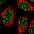 Immunofluorescent staining of human cell line U-2 OS shows localization to nuclear speckles & the Golgi apparatus.