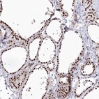 Immunohistochemical staining of human thyroid gland shows high expression.