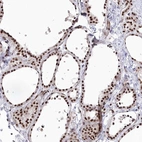 Immunohistochemical staining of human thyroid gland shows high expression.