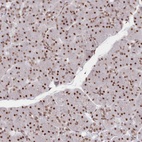 Anti-POLR2H Antibody