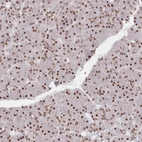 Immunohistochemical staining of human pancreas shows low expression as expected.