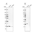 Western blot analysis using Anti-POLR2H antibody HPA037745 (A) shows similar pattern to independent antibody HPA055813 (B).