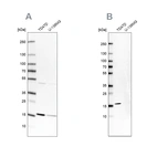 Western blot analysis using Anti-POLR2H antibody HPA037745 (A) shows similar pattern to independent antibody HPA055813 (B).