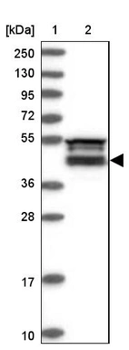 Lane 1: Marker [kDa] 250, 130, 95, 72, 55, 36, 28, 17, 10_br/_Lane 2: Human cell line RT-4