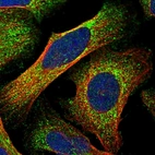 Immunofluorescent staining of human cell line U-2 OS shows localization to cytosol.