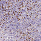 Immunohistochemical staining of human lymph node shows moderate to strong positivity in lymphoid cells.