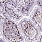 Immunohistochemical staining of human small intestine shows moderate to strong positivity in lymphoid cells.