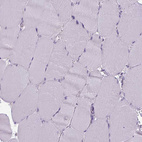 Immunohistochemical staining of human skeletal muscle shows no cytoplasmic positivity as expected.