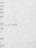 Anti-MBLAC2 Antibody