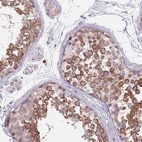 Immunohistochemical staining of human testis shows high expression.