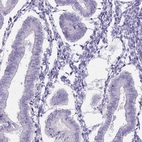 Immunohistochemical staining of human endometrium shows low expression as expected.
