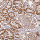 Anti-ARSB Antibody
