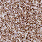 Immunohistochemical staining of human liver shows strong cytoplasmic granular positivity in cytoplasm in hepatocytes.