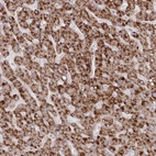 Immunohistochemical staining of human liver shows strong cytoplasmic granular positivity in cytoplasm in hepatocytes.