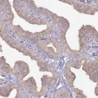 Immunohistochemical staining of human fallopian tube shows moderate cytoplasmic positivity in glandular cells.