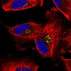 Immunofluorescent staining of human cell line U-251 MG shows localization to the Golgi apparatus.