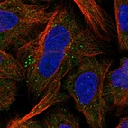 Immunofluorescent staining of human cell line U-2 OS shows localization to cytosol & vesicles.