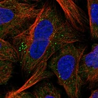 Immunofluorescent staining of human cell line U-2 OS shows localization to cytosol & vesicles.