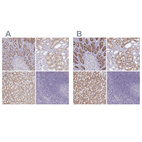 Anti-A1CF Antibody